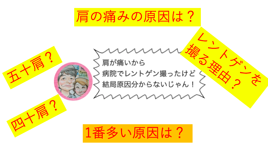 肩のレントゲンで異常ないけど痛い時のチェック ニアー ホーキンス ケネディのインピンジメントテスト